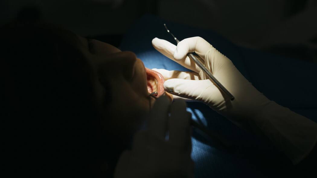 Berufsverbot: Vorsicht vor diesem Zahnarzt! Geöffneter Mund und Zahnarzthand in Handschuhen - Der verurteilte Zahnarzt Herbert Hatzlhoffer behandelte trotz Bewilligungsentzug monatelang in Aarau illegal weiter