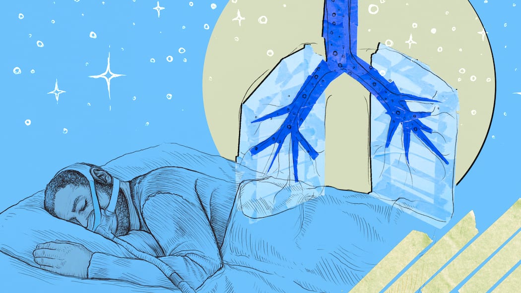 Gift aus dem Beatmungsgerät Beatmungsmaske Apnoe Philips