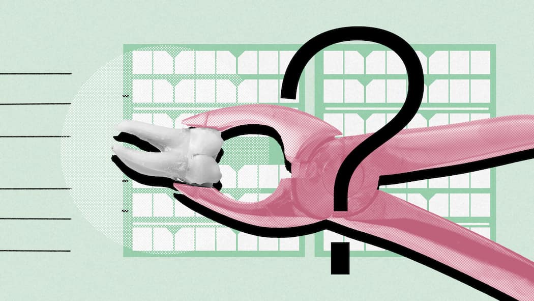 Kann ich die Zahnsanierung steuerlich absetzen? Eine Werkzeugzange zieht einen kranken Zahn heraus. Kann man Zahnarztkosten von den Steuern abziehen? Die gute Nachricht: Ja, das ist möglich, doch die Bedingungen dafür variieren von Kanton zu Kanton.