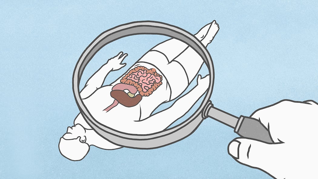 Was taugt ein Selbsttest bei Darmproblemen? Grafische Darstellung eines Patienten, dessen Darm unter die Lupe genommen wird.