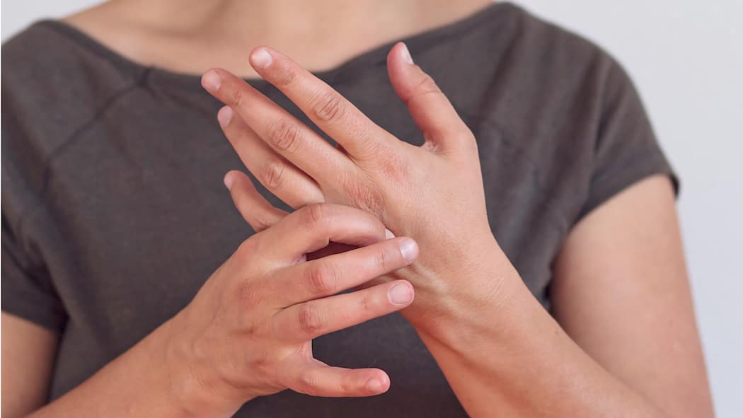 Gut gedrückt ist halb geheilt Eine Frau massiert sich mit der rechten Hand die linke.