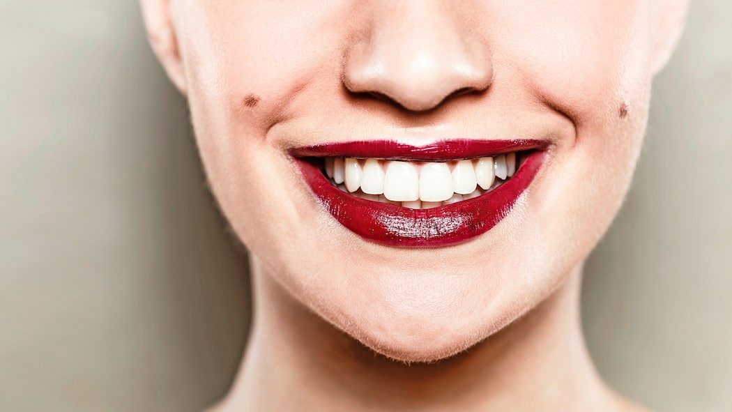 Weiss hat seinen Preis Eine Frau zeigt ihre strahlend weissen Zähne.