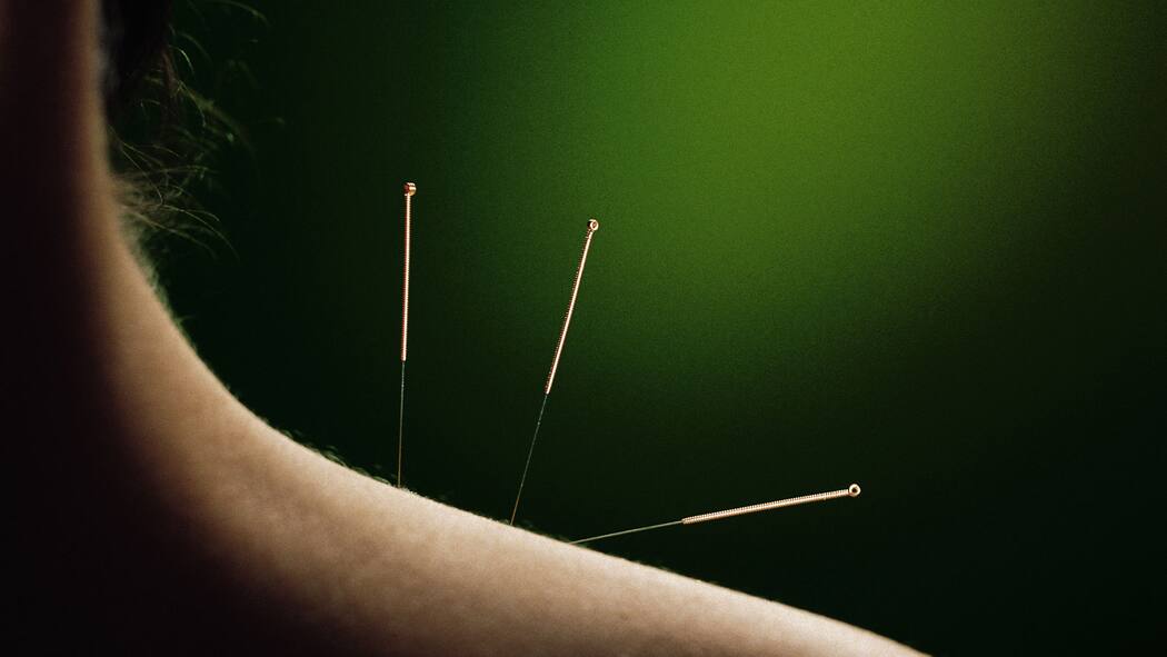 Nadelstiche als Wundermittel Nadelstiche als Wundermittel