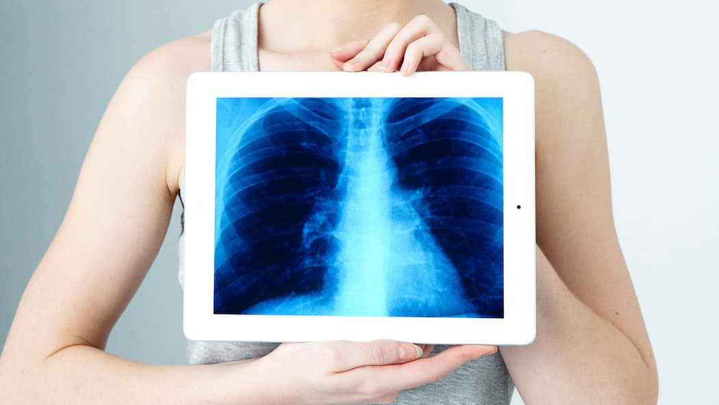 Was bringen Check-ups? Eine Frau hält während eines medizinischen Check-ups ein Röntgenbild auf einem Tablet vor ihre Brust.