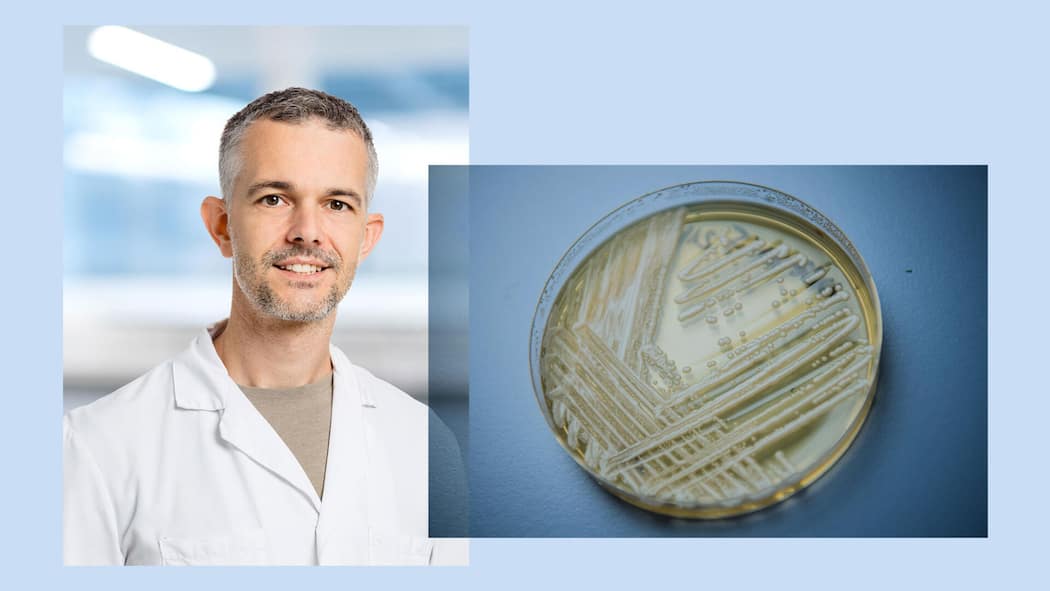 «Die meisten Spitalinfektionen entstehen durch körpereigene Bakterien» Collage aus Keystone-Bild 676806563_highres: ARCHIV - 23.01.2018, Bayern, W¸rzburg: Der Hefepilz Candidozyma auris (fr¸her bekannt als Candida auris) in einer Petrischale, aufgenommen in einem Labor der Universit‰t in W¸rzburg. (zu dpa: ´Kranke…