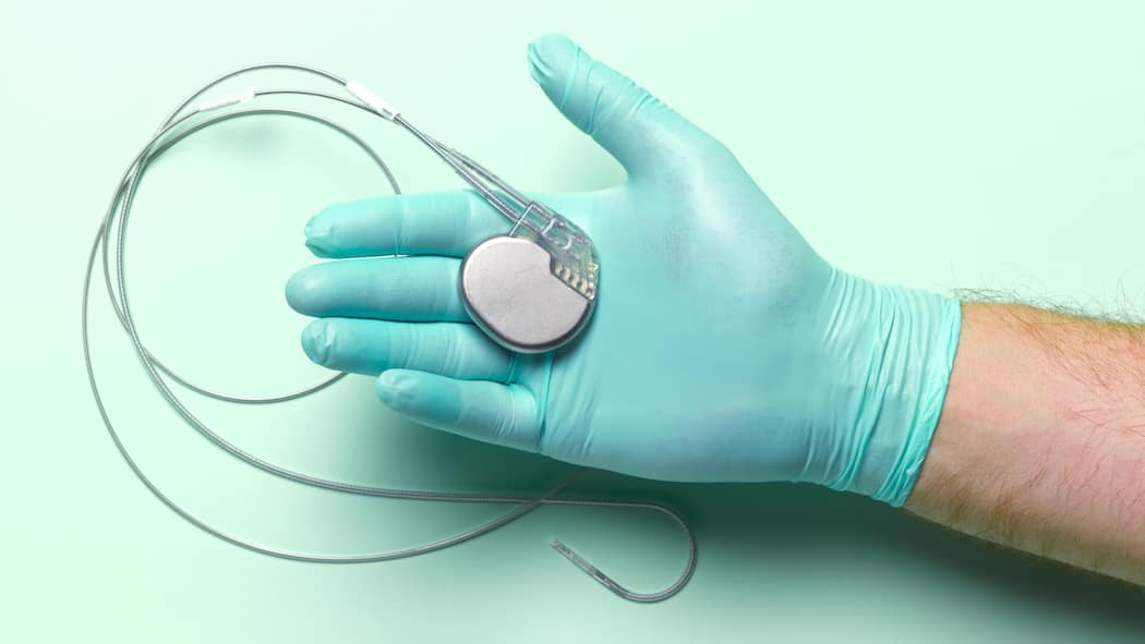 Wie Herzschrittmacher unsere Prämien in die Höhe treiben 136997842