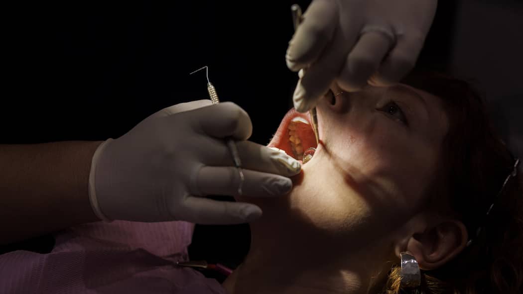 Strafuntersuchung gegen Zahnarzt – der wirbt weiter um Patienten A 47-year-old Caucasian woman receives a dental examination. A dentist's gloved hands use a scaler and a mouth mirror inside her open mouth. The scene is a close-up, low-angle view with dramatic lighting against a black background.