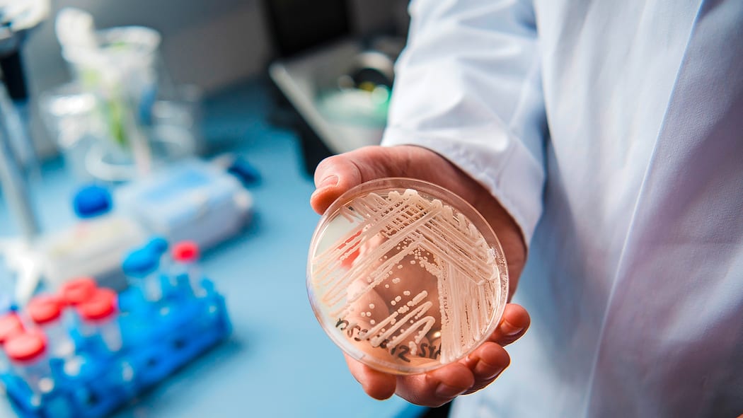 Dieser Pilz tötet Petrischale mit dem resistenten Hefepilz Candida auris.