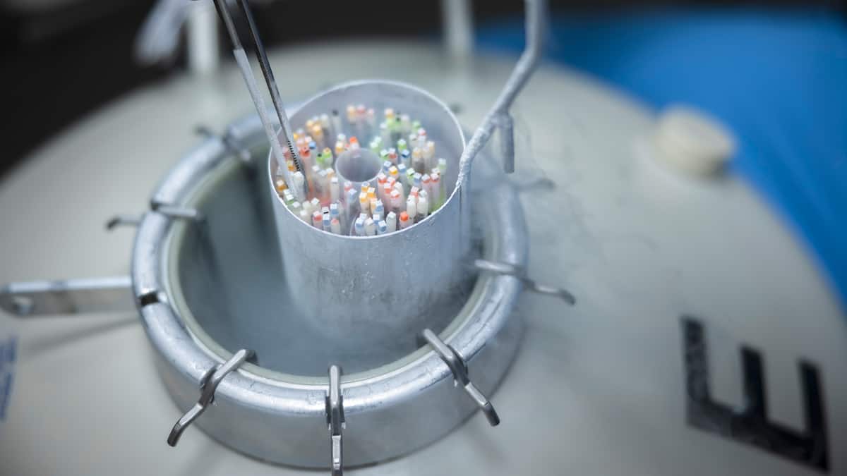 Schweizer Frauen setzen auf Eizellenkonservierung – jetzt soll sie günstiger werden Schweizer Frauen setzen auf Eizellenkonservierung – jetzt soll sie günstiger werden