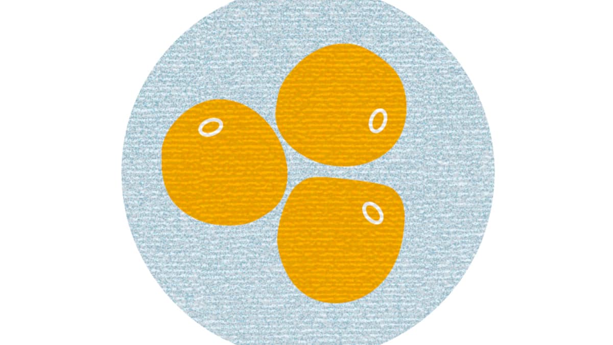 Illustration Viszeralfett