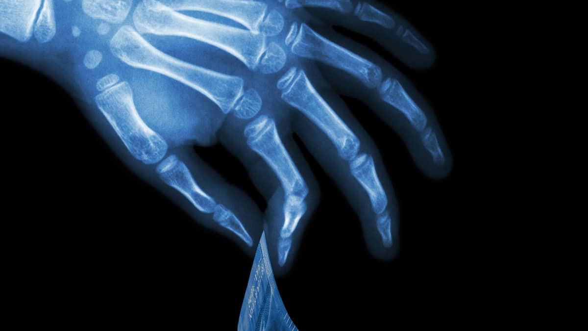 Leak enthüllt Luxuslöhne in der Radiologie Leak enthüllt Luxuslöhne in der Radiologie