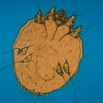 Krätze-Milben halten Ärzte und Spitäler auf Trab Mikroskop-Aufnahme einer Krätzmilbe.