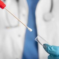 Betroffene von Gewalt: Bundesrat will spezialisierte Stellen schaffen Hände in medizinischen Handschuhen stecken ein Wattestäbchen in ein Glasröhrchen