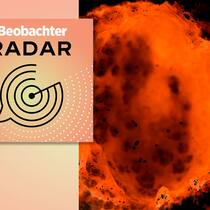 Dem Schmerz auf der Spur Dolografie: visuelle Kommunikationshilfe für die Schmerztherapie;