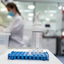 Ärzte erhalten bis zu 70 Millionen Franken von Labors Labormitarbeiterinnen untersuchen Proben in einem Labor.