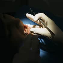 Berufsverbot: Vorsicht vor diesem Zahnarzt! Geöffneter Mund und Zahnarzthand in Handschuhen - Der verurteilte Zahnarzt Herbert Hatzlhoffer behandelte trotz Bewilligungsentzug monatelang in Aarau illegal weiter