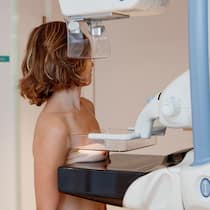 Soll ich zum Brustkrebs-Screening? Eine Frau unterzieht sich einer Mammografie.