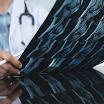Mit diesen Tricks treiben Spitäler die Gesundheitskosten in die Höhe Orthopedics surgeon doctor examining patient's knee joint x-ray films, MRI bone, ct scan in at radiology orthopedic unit in hospital. knee joint film x ray, close up