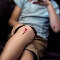 7 Antworten zu Hemgenix, dem teuersten Medikament der Welt Junge mit aufgeschürftem Knie. Kindern und Jugendlichen kann Hemgenix nicht verabreicht werden.