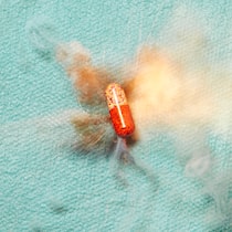 Das macht die Schweiz falsch Explosion der Gesundheitskosten (Symbolbild); Krankenkassenprämien: Was die Schweiz falsch macht, Unser Land finanziert die Gesundheit mit Abstand am asozialsten. Welche Erkenntnisse der Blick ins Ausland sonst noch bringt.