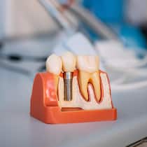 Das sind die drei häufigsten Fehler auf der Zahnarzt-Rechnung Teeth Model on Dentist's Office1288062288