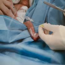 Zu klein für dieses Leben? Eine Pflegerin hantiert mit Schläuchen an einem Frühchen. In der Medizin ist heute fast alles möglich, das stellt Eltern von Frühgeborenen manchmal vor schwierige Entscheidungen: Ein Besuch im Unispital Zürich