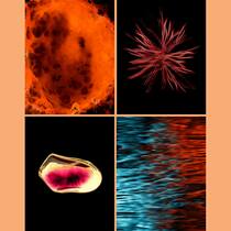 «Ich habe Schmerzen» – was heisst das eigentlich? Dolografie - Schmerzen bestimmen den Alltag, fordern mentale Stärke und oft eine komplette Neuorientierung. Vier Betroffene erzählen dem Beobachter, wie sie damit umgehen