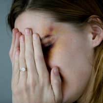 Mehr Schutz vor häuslicher Gewalt – aber nicht genug Eine Frau deckt sich mit den Händen ihre Augen zu. Sie trägt einen Ehering.