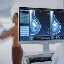 Studien widersprechen dem Nutzen von Brustkrebs-Screenings Brust-Screen auf Computer - Politiker fordern ein nationales Programm für Brustkrebs-Screening. Dabei vergessen sie: Mammografien für alle Frauen über 50 haben keinen Nutzen – im Gegenteil