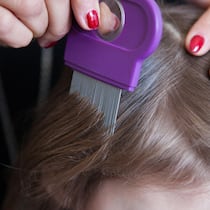 Ihre Tochter hat schon seit drei Jahren Läuse – jetzt reichts den Eltern Frau kämmt Kind mit Läusekamm - Kinder eines Stadtberner Schulhauses haben alle paar Wochen Läuse. Eltern finden, die Schulleitung unternehme zu wenig. Was Schulen tun können – plus die besten Tipps gegen Nissen