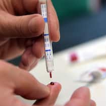 Was taugt der HIV-Test für zu Hause? HIV-Selbsttest