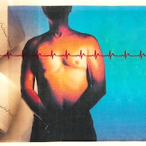 Wie geht es Herz und Kreislauf? Das EKG eines Mannes wird vor ihm projiziert.