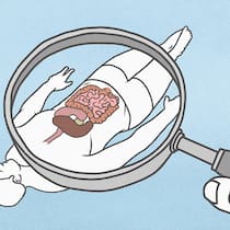 Was taugt ein Selbsttest bei Darmproblemen? Grafische Darstellung eines Patienten, dessen Darm unter die Lupe genommen wird.