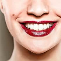 Weiss hat seinen Preis Eine Frau zeigt ihre strahlend weissen Zähne.