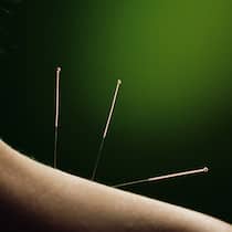 Nadelstiche als Wundermittel Nadelstiche als Wundermittel