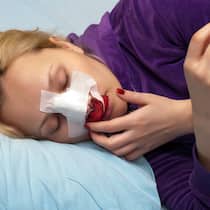 Muss ich für die Operation Ferien nehmen? Eine Frau liegt mit einer bandagierten Nase auf einem Spitalbett - Muss eine Angestellte wegen einer geplanten Operation Ferientage beziehen? Der Beobachter erklärt, was arbeitsrechtlich gilt.
