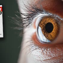 Augenärzte müssen Millionen zurückzahlen Beobachter-Cover von 2018 und ein Auge