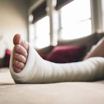 Bundesgericht lässt Mutter abblitzen – Gipsbein genügt nicht für Betreuungsurlaub Kinderfuss im Gips - Nach einem Sturz pflegt eine Mutter ihren verletzten Sohn drei Monate lang zu Hause. Eine Entschädigung erhält sie dafür nicht. Wie der Anspruch auf Betreuungsurlaub für Eltern geregelt ist