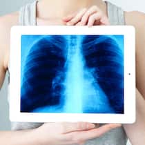 Was bringen Check-ups? Eine Frau hält während eines medizinischen Check-ups ein Röntgenbild auf einem Tablet vor ihre Brust.