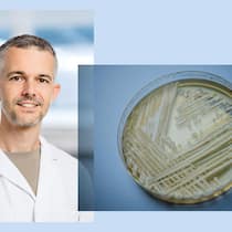 «Die meisten Spitalinfektionen entstehen durch körpereigene Bakterien» Collage aus Keystone-Bild 676806563_highres: ARCHIV - 23.01.2018, Bayern, W¸rzburg: Der Hefepilz Candidozyma auris (fr¸her bekannt als Candida auris) in einer Petrischale, aufgenommen in einem Labor der Universit‰t in W¸rzburg. (zu dpa: ´Kranke…