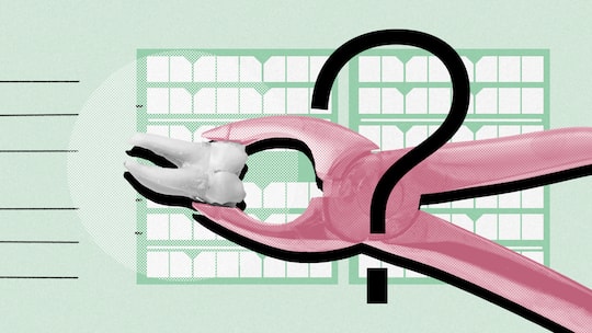 Eine Werkzeugzange zieht einen kranken Zahn heraus. Kann man Zahnarztkosten von den Steuern abziehen? Die gute Nachricht: Ja, das ist möglich, doch die Bedingungen dafür variieren von Kanton zu Kanton.