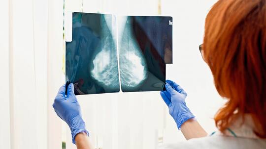The doctor looks at the x-ray of the female mammary glands. Hardware examination of the breast.