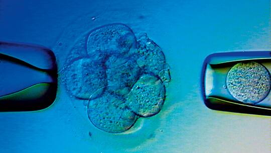 Gibt es ein Recht auf ein gesundes Baby?