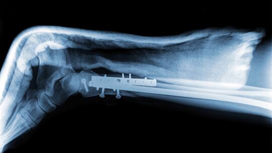 Wer bezahlt die zweite Operation?