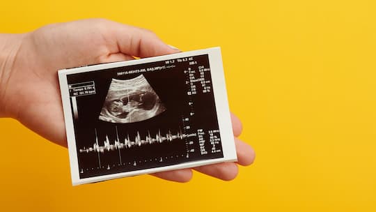 Eine Frau hält ein Ultraschallbild ihres Kindes in der Hand.