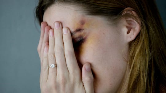 Eine Frau deckt sich mit den Händen ihre Augen zu. Sie trägt einen Ehering.