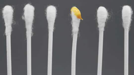 Vorsicht mit Wattestäbchen: Durch Sie wird das Ohrschmalz meist nur noch tiefer in den Gehörganz hineingedrückt.