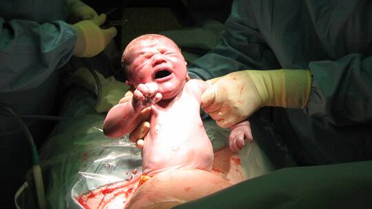 Der sichere Schnitt ins Leben?