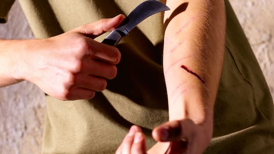 «Meine Tochter ritzt sich»