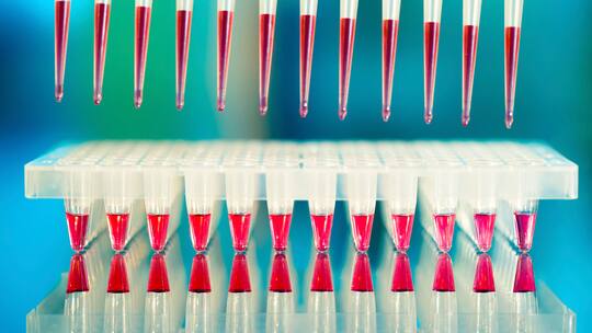 Oft kein Geld für Gentests